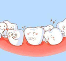 武汉牙齿拥挤矫正价格是多少